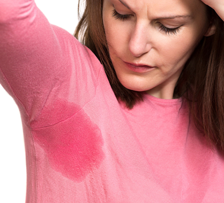 hiperhidrosis
