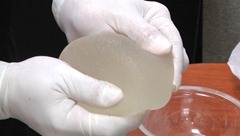 Implantes PIP con gel filtrado