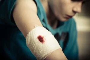 Científicos desarrollan polvo que podría detener hemorragias graves en aproximadamente un segundo
